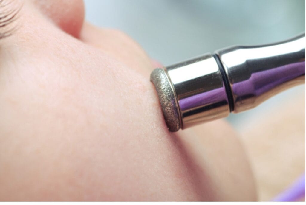 Δερμοαπόξεση